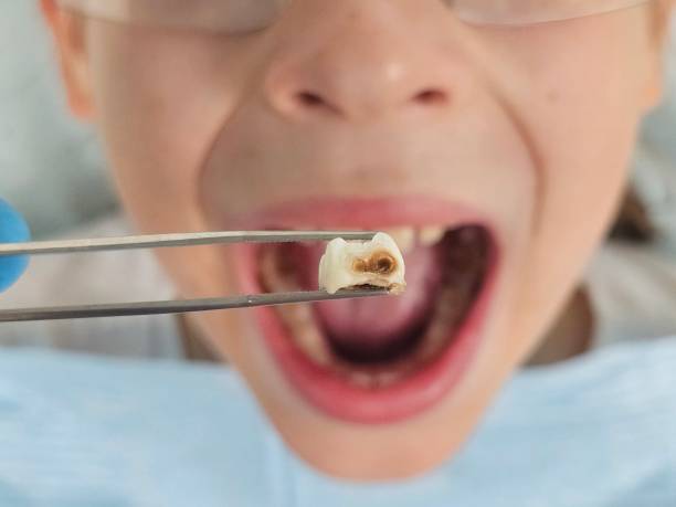 Best Emergency Pediatric Dental Care in Ferndale, PA